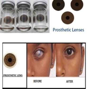 Blind Eye Contact lens